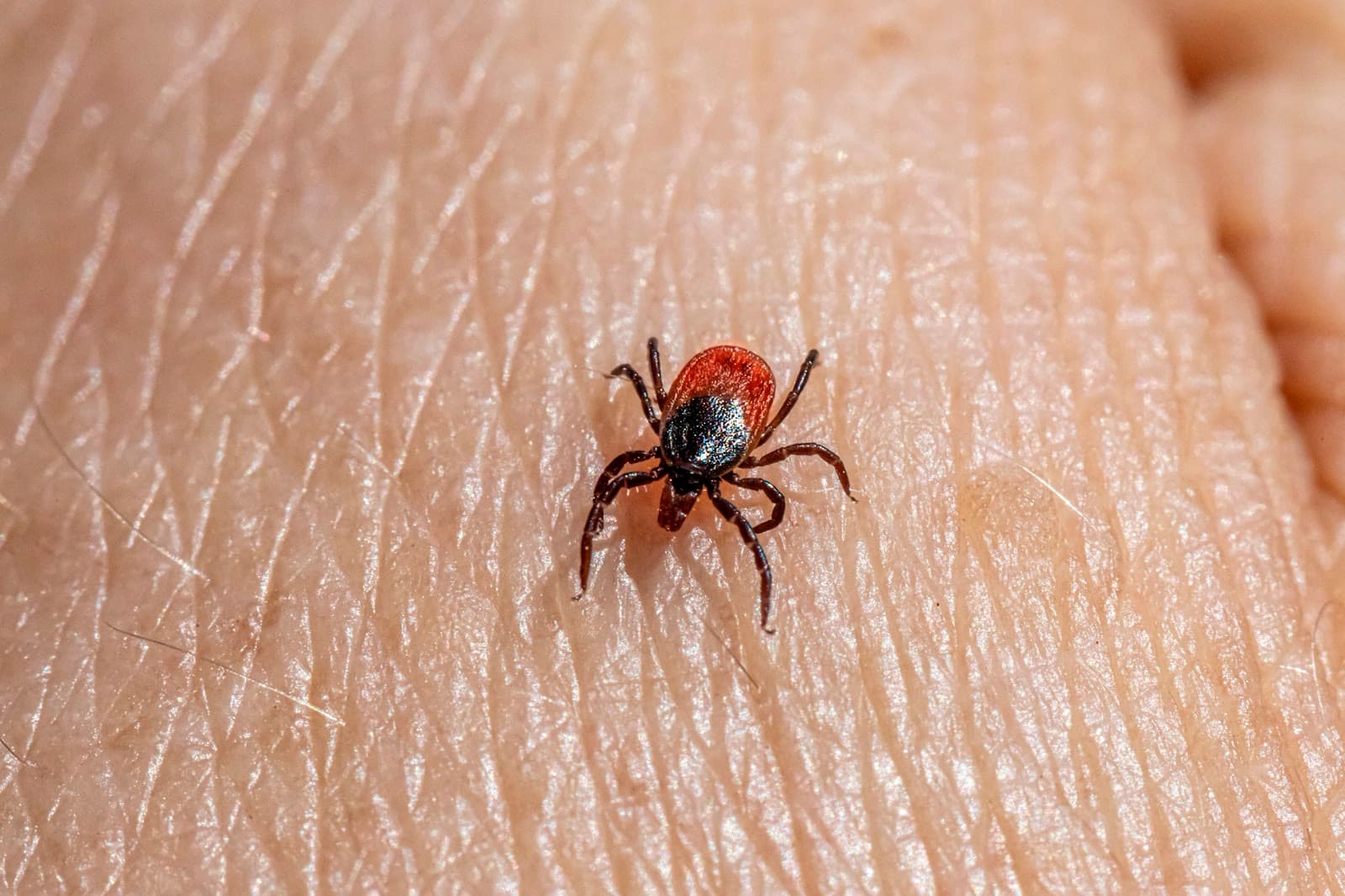A tick on a person’s skin